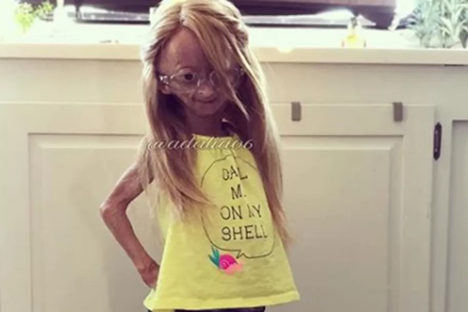ADALIA ROSE