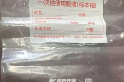 Lo llevaron al hospital porque le dolía la cabeza y le encontraron dientes en el cerebro