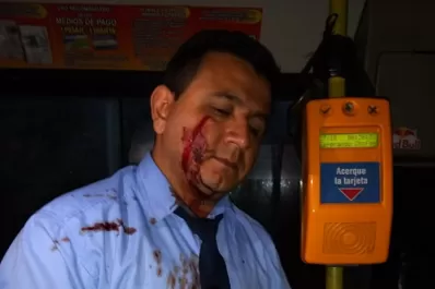 Le cortaron la cara y las manos a un chofer de colectivos en Las Talitas