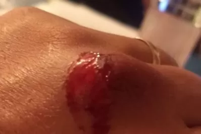 Una mujer mordió a un comisario de Alderetes para exigir que libere a su hijo