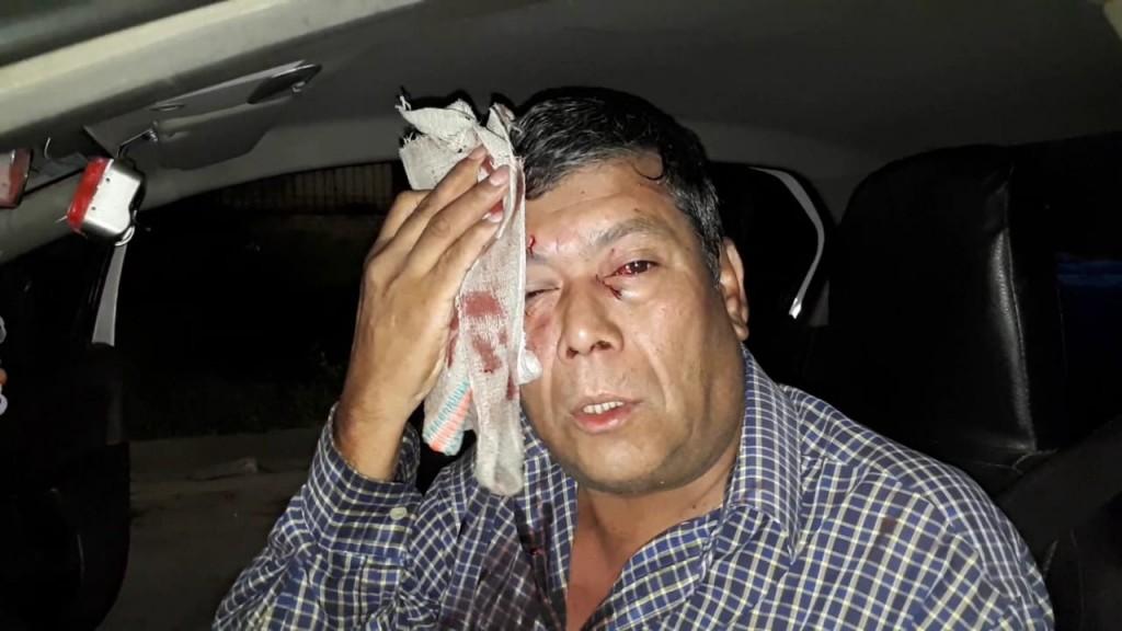 Dos intentos de robos en pocas horas: balearon a un policía y golpearon a un taxista 