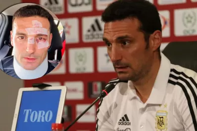 Scaloni fue atropellado en Mallorca y sufrió heridas leves