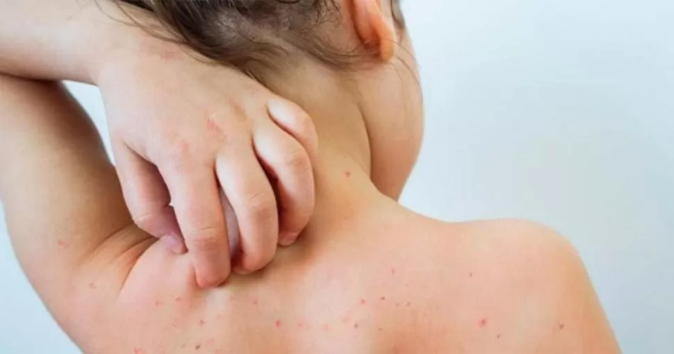 PREVENCIÓN. Tenés que asegurarte que todos tengan las vacunas al día.  