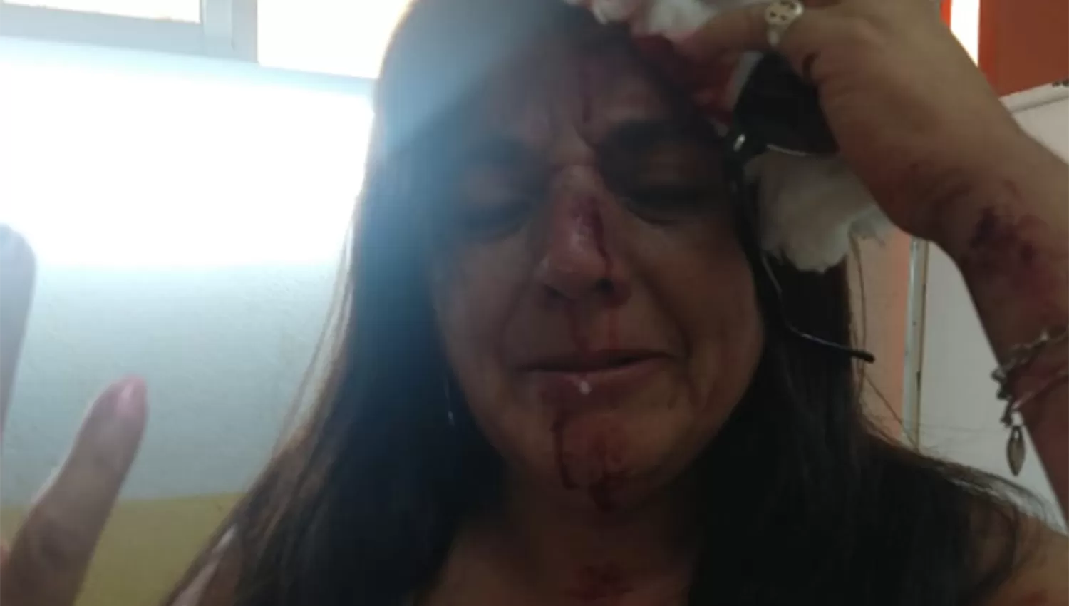 Inseguridad: brutal ataque a una mujer para robarle la cartera