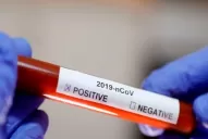 Adelanto: entrevista exclusiva con la primera tucumana diagnosticada con coronavirus