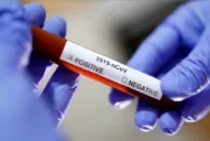 Nueva York empieza a fabricar test de coronavirus: serían 50.000 por semana