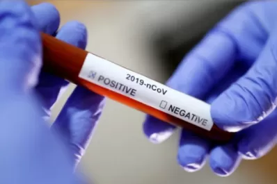 Nueva York empieza a fabricar test de coronavirus: serían 50.000 por semana