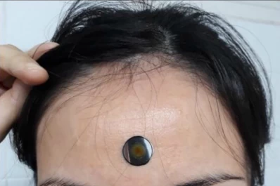 Tucumanos crearon un termómetro adhesivo que indica si alguien tiene fiebre en segundos