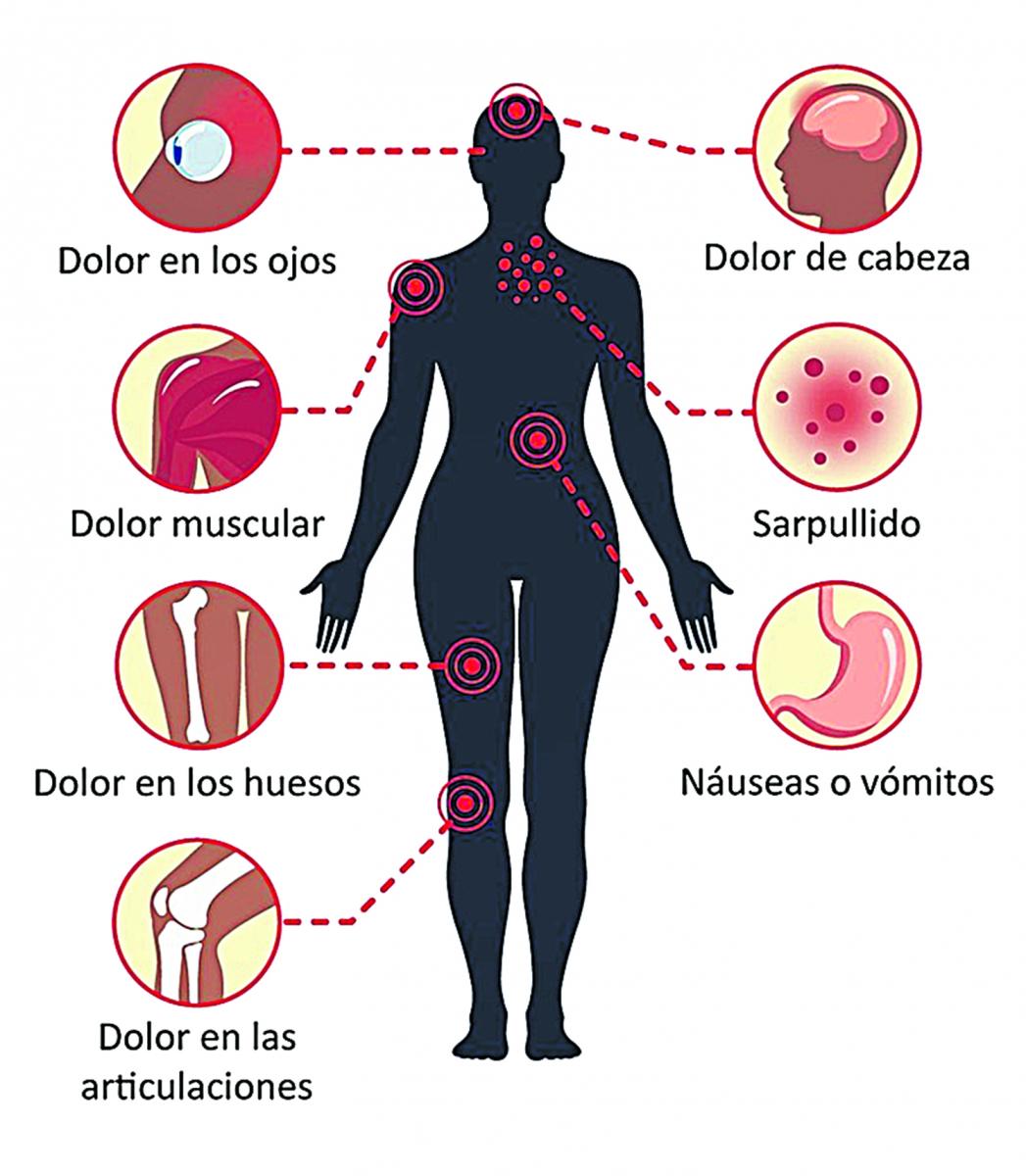 Diez mitos y errores sobre la fiebre quebrantahuesos