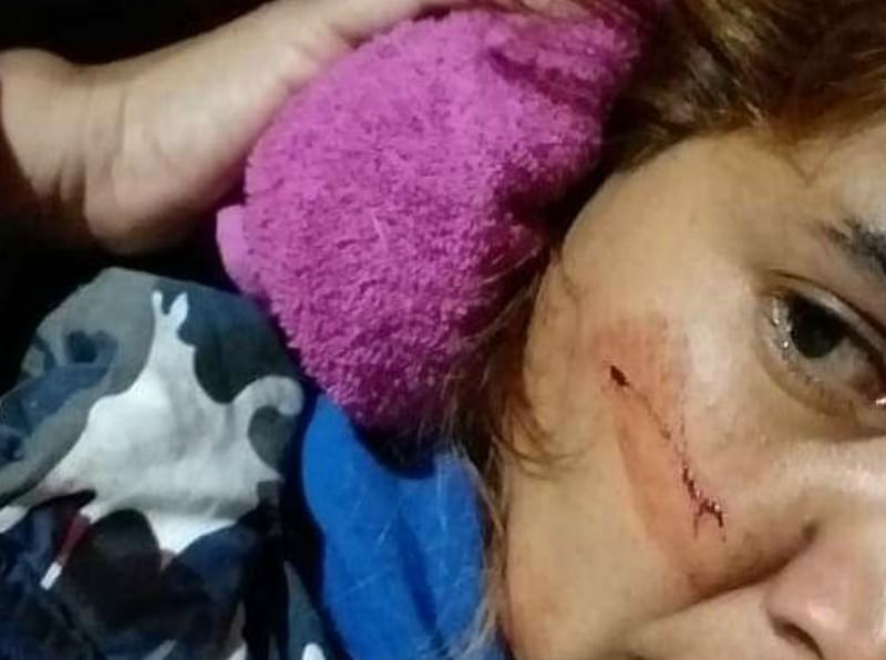 Le dispararon para robarle pero se salvó de milagro: la bala le rozó el cachete