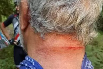 Se extiende el cobro de peaje ilegal en el cerro