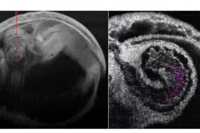 Nuevo método: ahora se puede estudiar el corazón en 4D