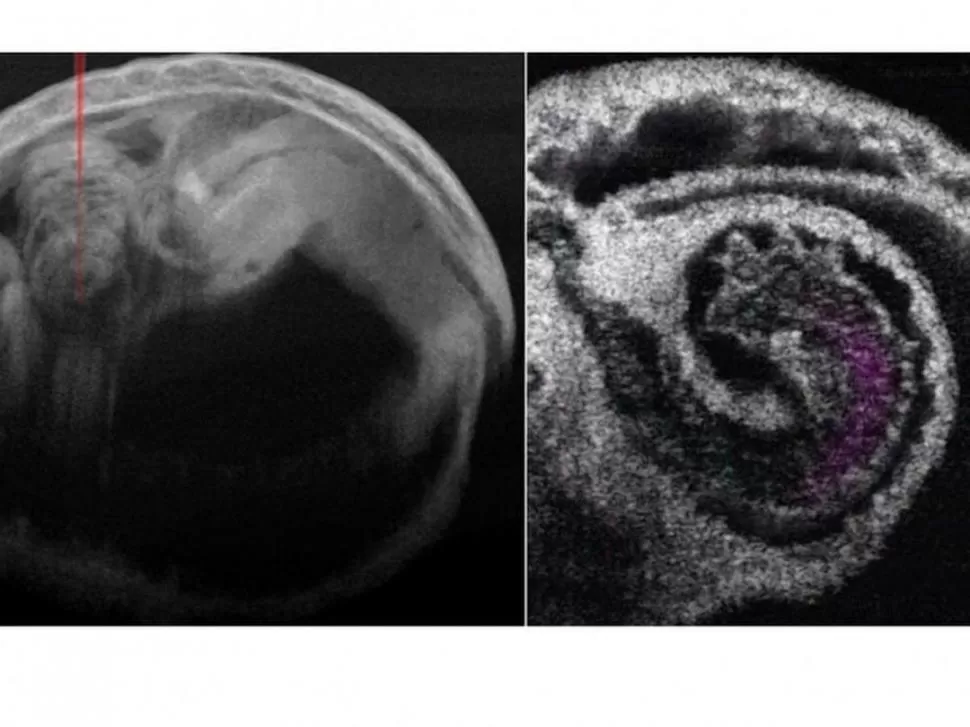 ÚTIL. Con este método se pueden conocer defectos cardíacos congénitos.  