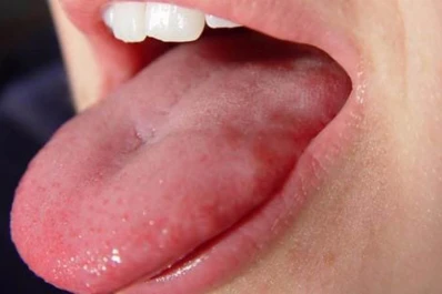 Investigación en EE.UU.: una célula gustativa detecta todos los sabores menos el salado