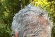 Piden la libertad del acusado de lastimar a un endurista