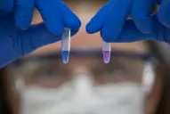 Argentina superó los 400.000 pacientes de covid-19 y sumó 48 muertes