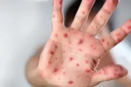 Campaña de vacunación Doble Viral: Conocé a quiénes va dirigida