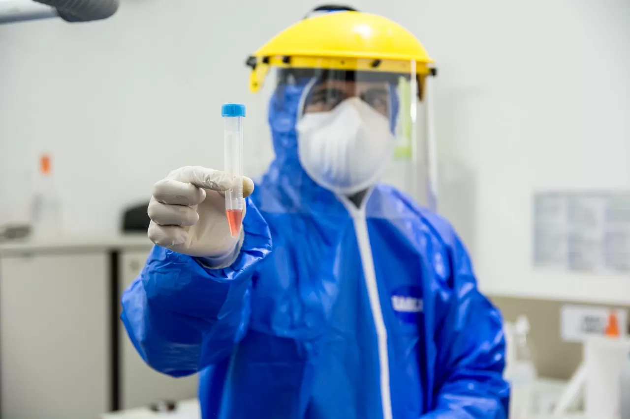 ESTUDIOS POR COVID-19. Foto: Prensa YB