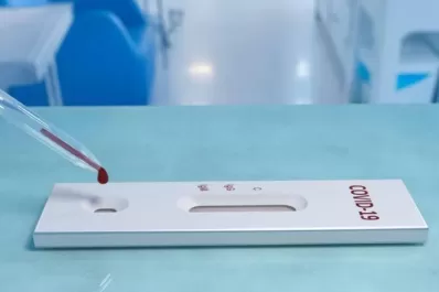 Laboratorio Vargas Rizo: ¿en qué consiste el test rápido?