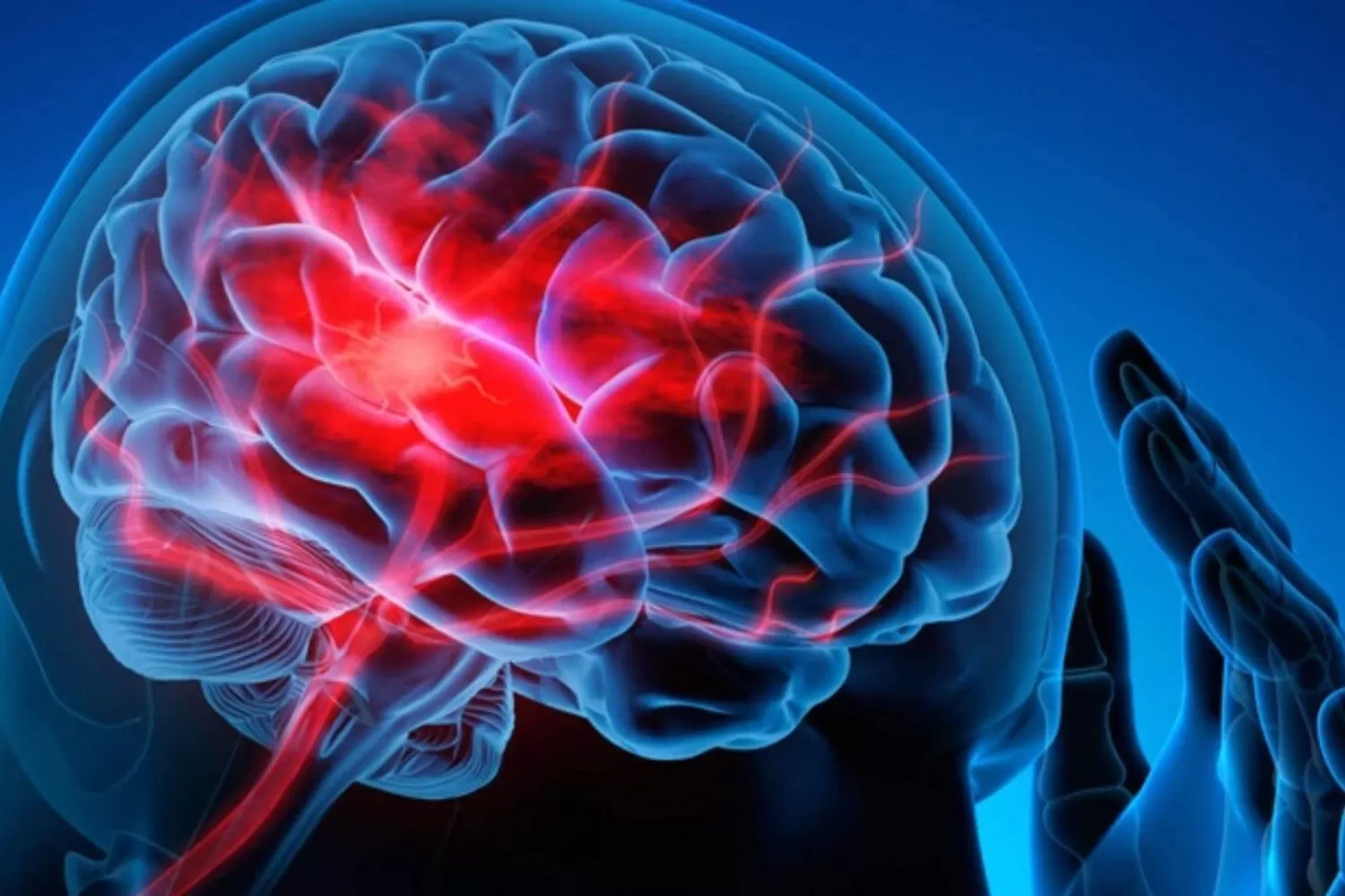CADA SEGUNDO CUENTA. Cuando ocurre un ACV, en un minuto se mueren más de 2 millones de neuronas.