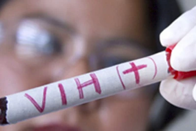 Acciones en la Semana Mundial del VIH/Sida