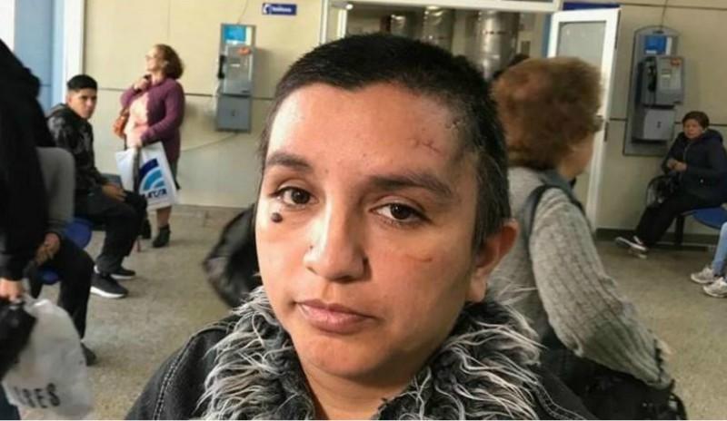 LA VÍCTIMA. Fatima Aparicio sobrevivió de milagro al ataque de su ex marido.