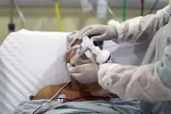 Brasil tiene más pacientes jóvenes que mayores internados por covid-19