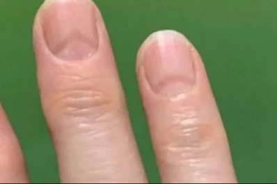 El coronavirus deja huellas en las uñas, según la ciencia: cuáles son esas marcas