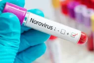 Norovirus: en 2019 se habían registrado brotes en San Luis y en Bariloche