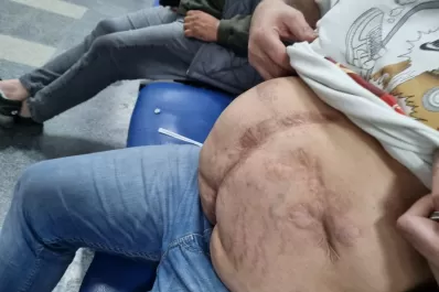 Internaron de urgencia a uno de los presuntos autores del robo a la joyería