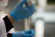 El suero equino hiperinmune demostró una alta capacidad neutralizante contra la variante Delta de coronavirus