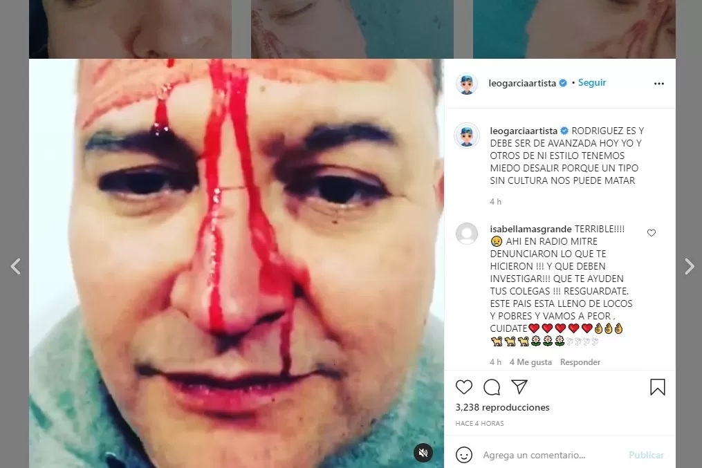 EN INSTAGRAM. El artista Leo García expuso detalles de la brutal paliza que recibió en General Rodríguez.