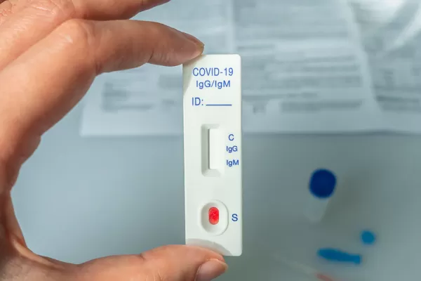 Anmat aprobó un test serológico que detecta anticuerpos de covid en segundos: cuánto cuesta