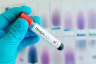 ¿Por qué hasta ahora no teníamos una vacuna segura contra el dengue?      