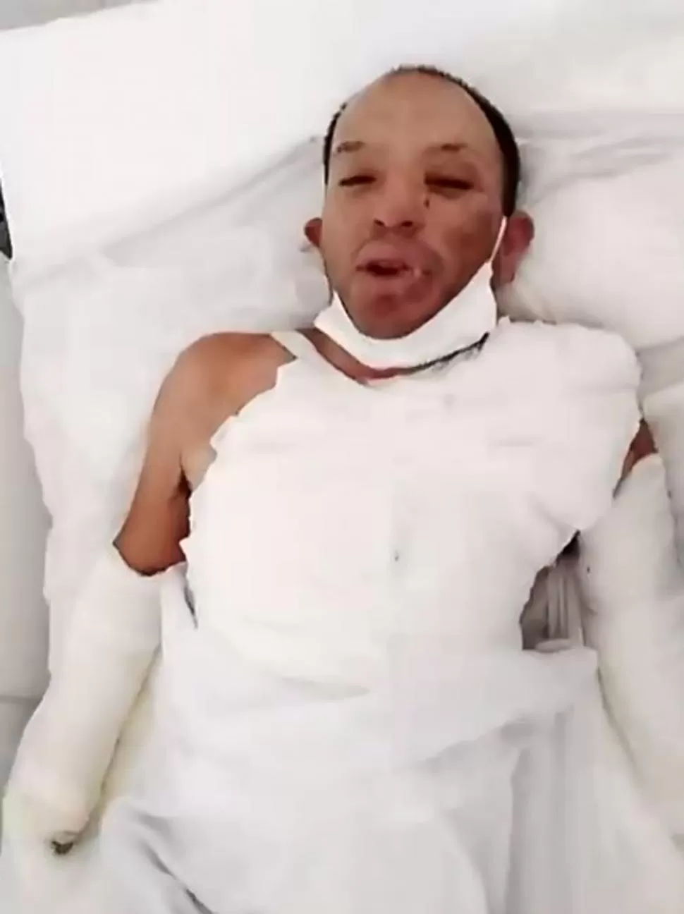 INTERNADO. El acusado dijo que la joven intentó quitarse la vida prendiéndose fuego. Seguirá detenido. 