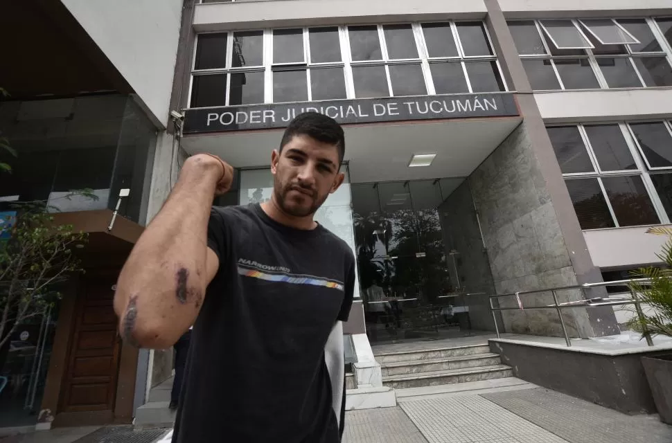 LA VÍCTIMA. Santiago Pintos, estudiante universitario de 25 años, muestra algunas de las marcas que le quedaron después de recibir la golpiza. 