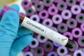 Coronavirus en América: La OPS advirtió que los casos subieron un 23% en la última semana