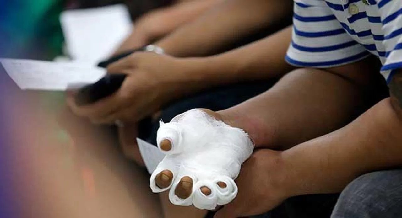 La jefa del área de emergencias del hospital de niños explica cuáles son los accidentes más comunes en verano