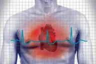 Lipotimia y síncope: ¿En qué se diferencian y cómo actuar en cada caso?