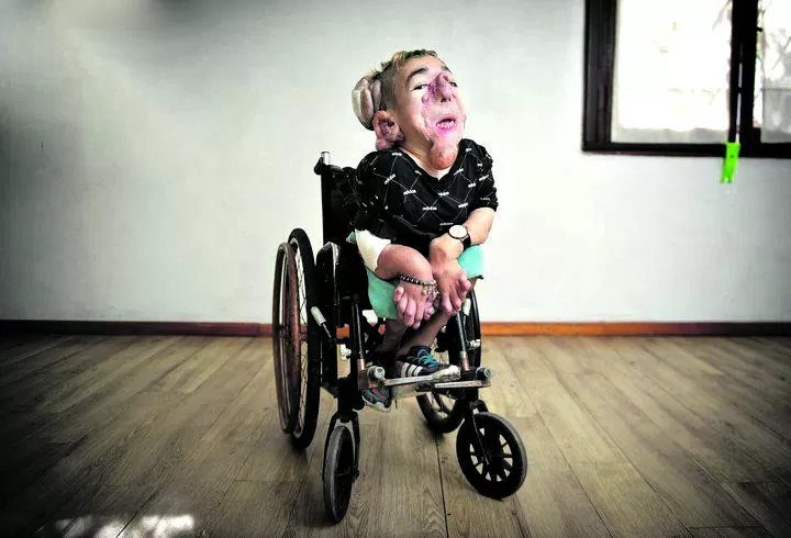 MATÍAS FERNÁNDEZ BURZACO