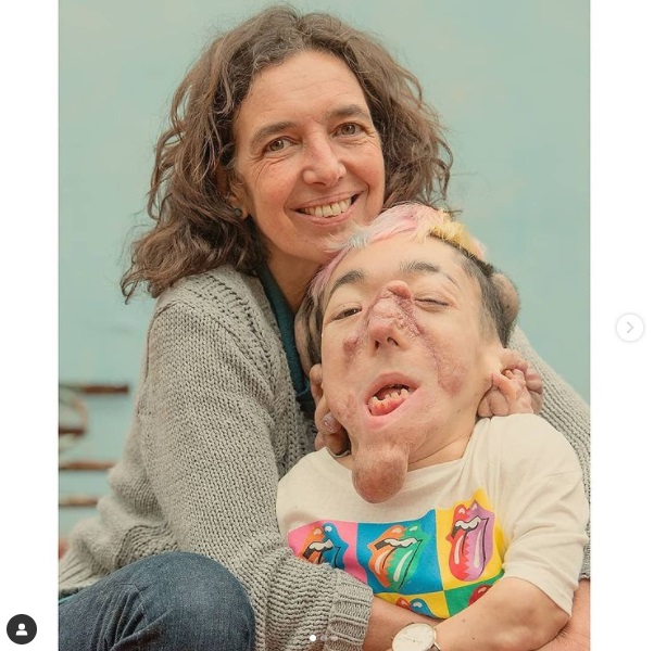 CON SU MAMÁ. En el libro “Formas Propias”, Matías relata sin tapujos su historia de vida.  