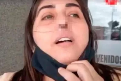 Le hicieron mal un hisopado y perdió el cartílago de su nariz