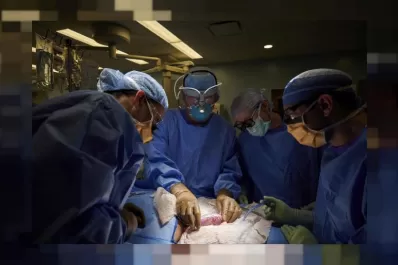 Buscan posibilitar trasplantes de órganos de animales en humanos