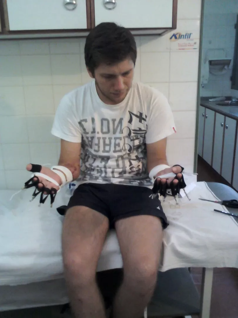 HOY Y AYER. Flores desarrolla sus actividades laborales y hogareñas sin problemas, si bien ha tenido que hacer adaptaciones. En la foto superior derecha, aparece en los tiempos inmediatos al accidente. Abajo, con el cirujano José Urpi, quien le reimplantó los brazos.