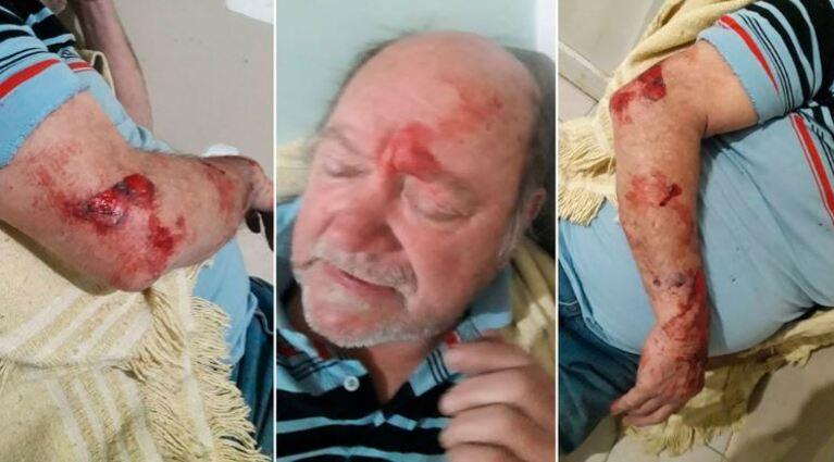 Jorge Ríos fue golpeado salvajemente antes de asesinar al ladrón