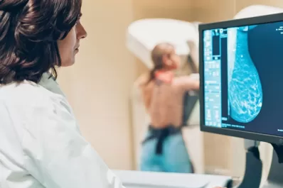 En 2020 se detectaron 22.000 casos de cáncer de mama