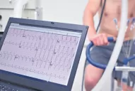 Si tuviste covid-19, chequeo médico antes de hacer ejercicio