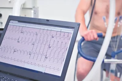 Si tuviste covid-19, chequeo médico antes de hacer ejercicio