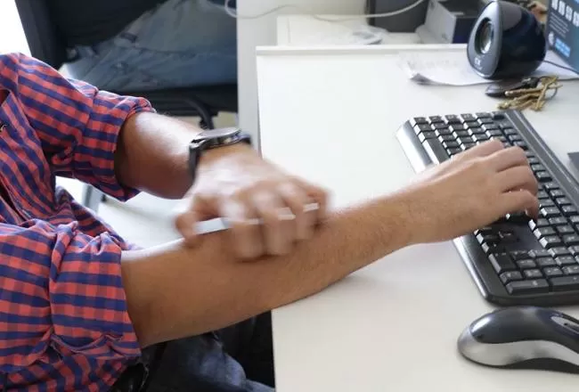 Pica y no para de picar. Urticaria crónica, hay que tomarla en serio. 