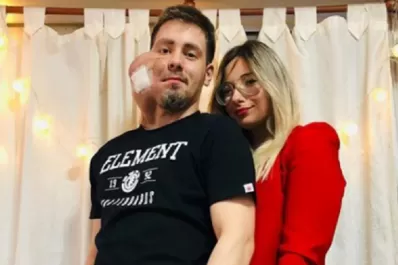 Murió el joven que tenía un extraño tumor en su cara y que conmovió por su lucha